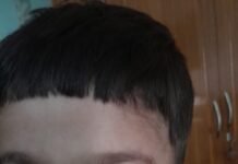 चाइनीज मांझे की चपेट में आने से तीन साल का मासूम घाय